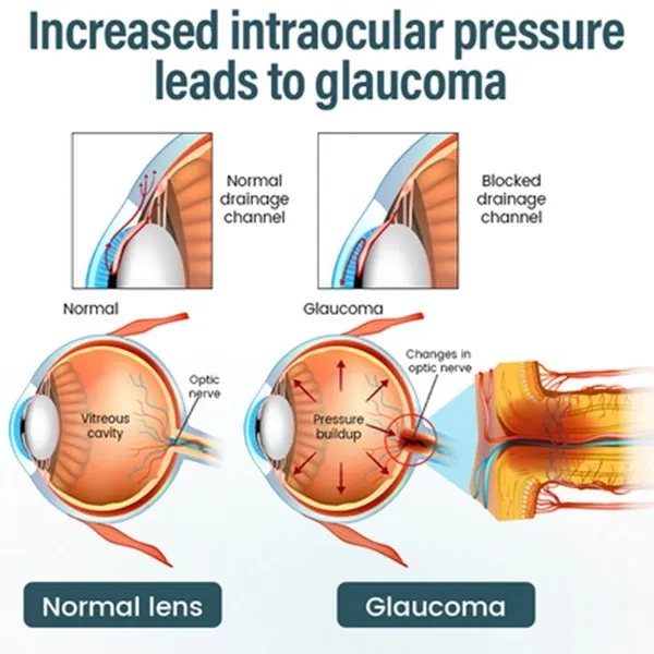 Elycura™ Nano Eye Drop Serum with lutein and quercetin